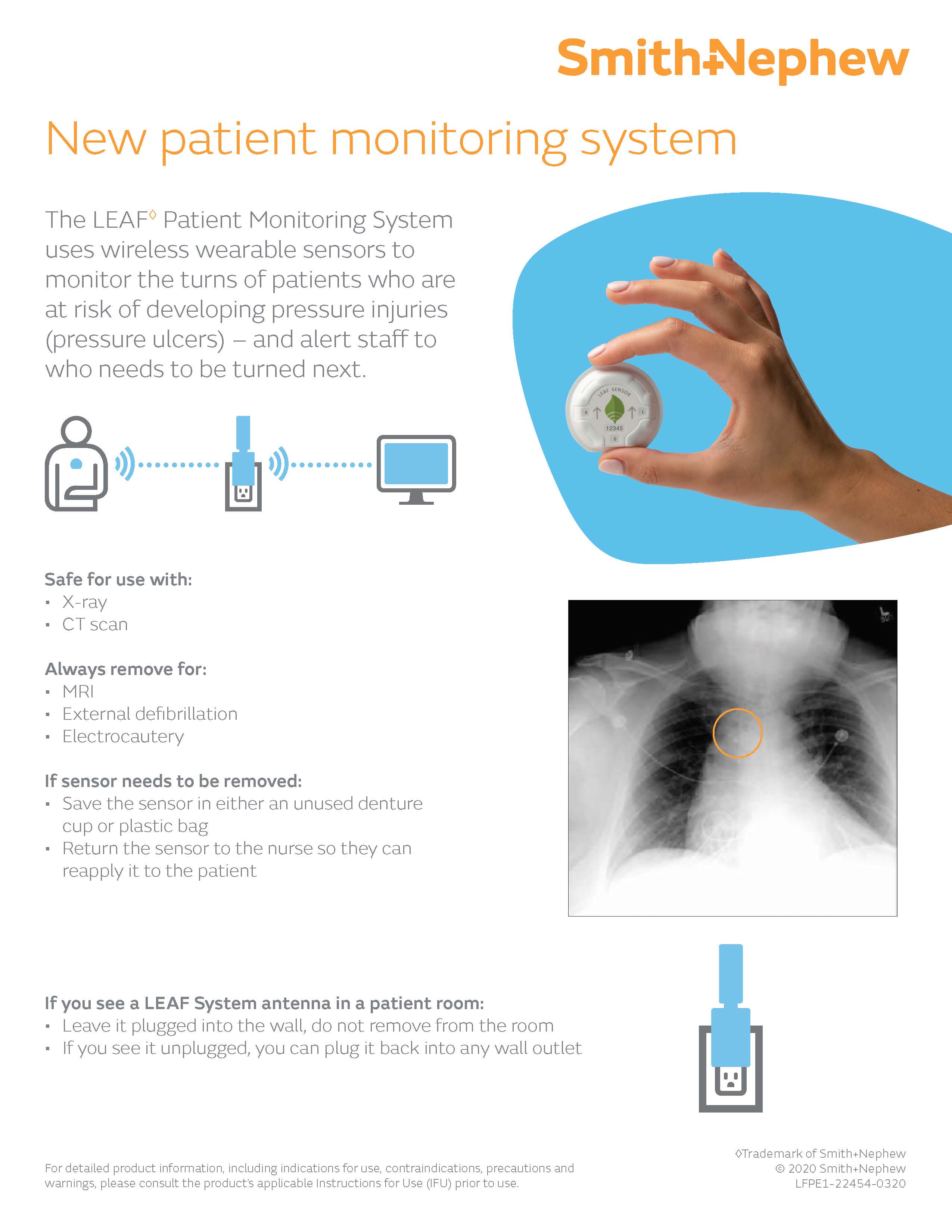 New patient monitoring system