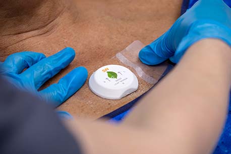 wearable patient sensor